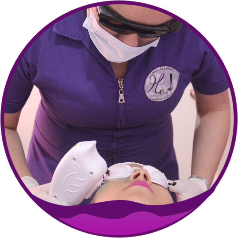 Fotorejuvenecimiento Facial IPL